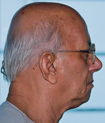 jha-2